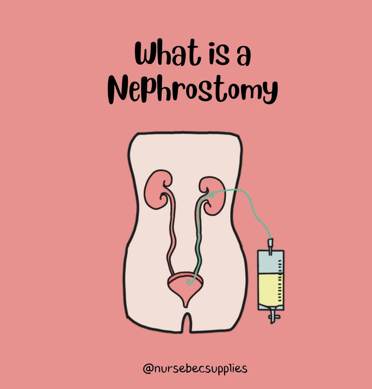 What is a Nephrostomy? Nurse Bec Supplies